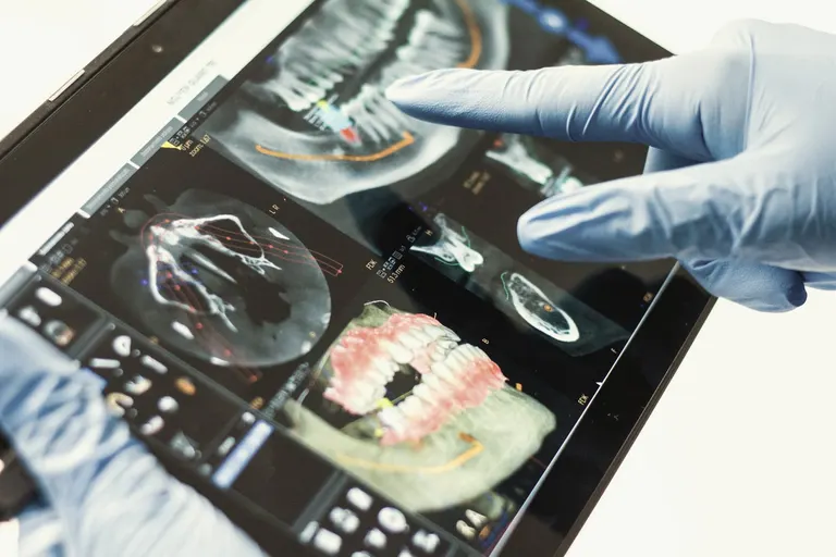 Scansione 3D della mandibola e dei denti su tablet