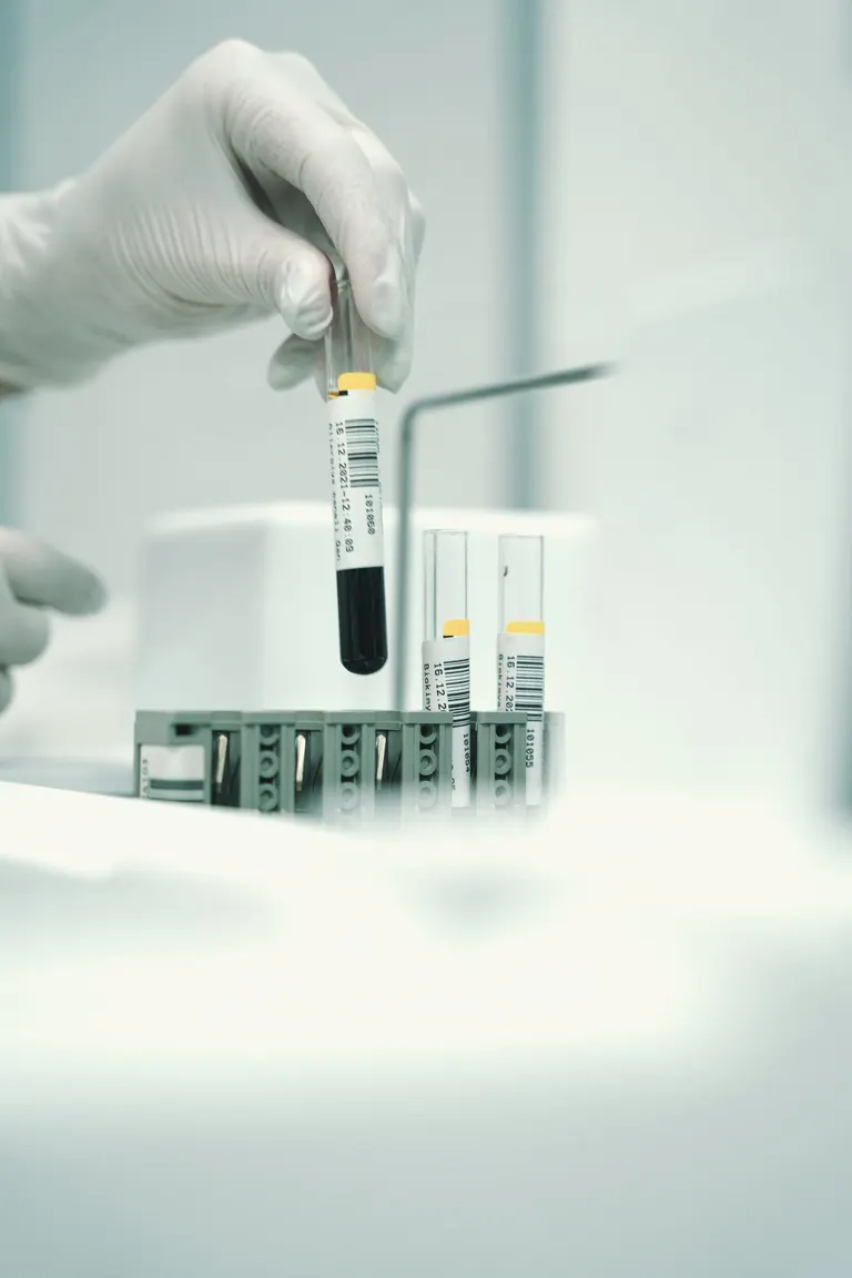 Provette per gli esami ormonali in laboratorio